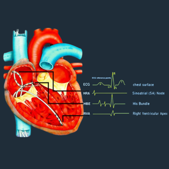 Best Cardiac Electrophysiologist in Bangalore | Dr. Ameet Oswal